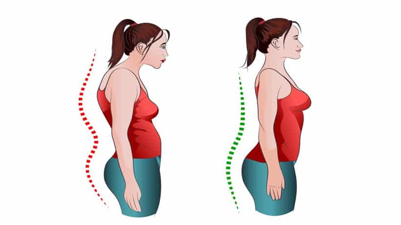 Poor Posture Affects More Than Your Appearance - Cianci Chiropractic Center